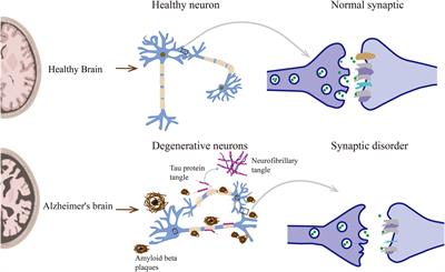 Epigenetic regulation of synaptic disorder in Alzheimer’s disease